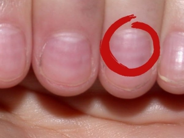 What do your nails say about your&nbsp;health?